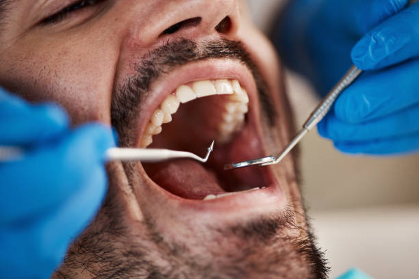 Best Cosmetic Emergency Dentistry in Staunton, IL